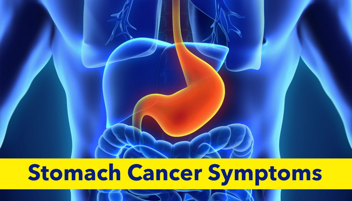 Stomach Cancer Symptoms